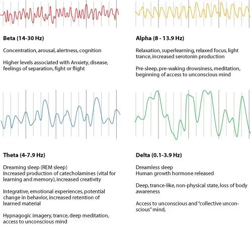 Brainwave-Chart